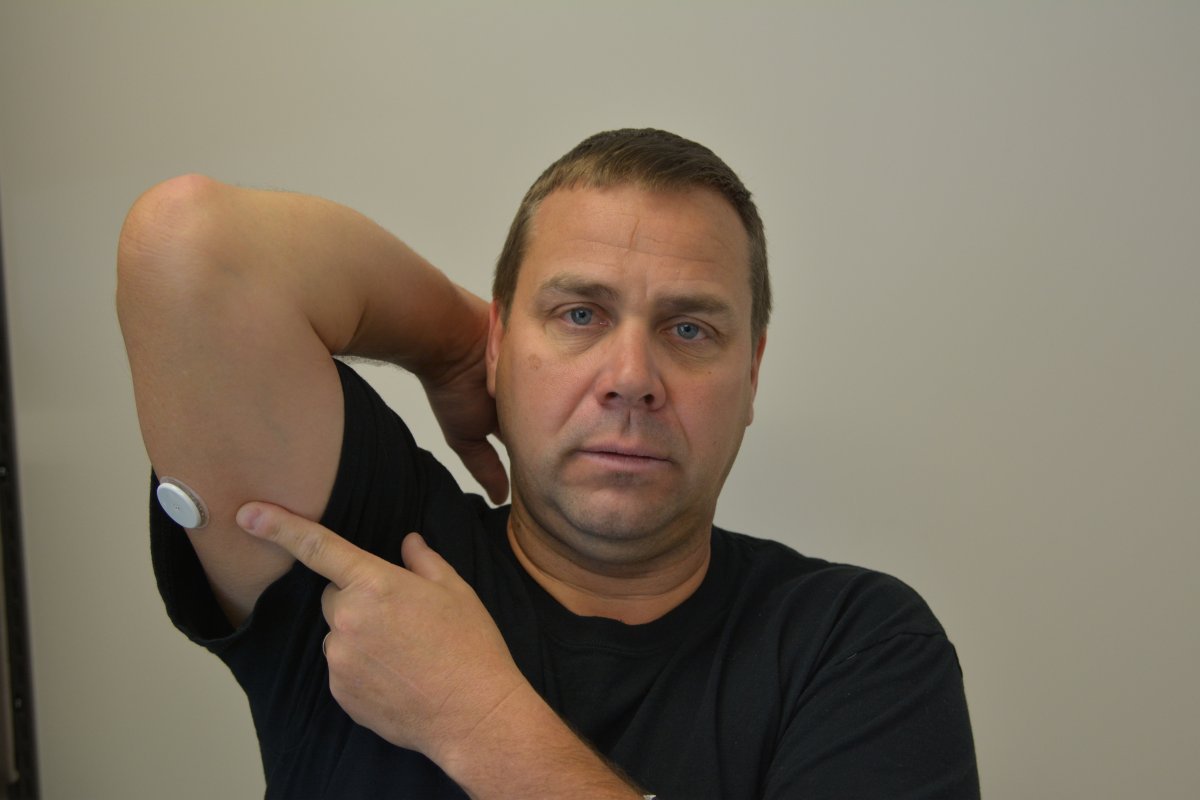 Jason Howard, 47, of London uses a revolutionary flash glucose monitoring system that can read glucose levels through a painless scan of a sensor worn on the arm – no finger prick needed.