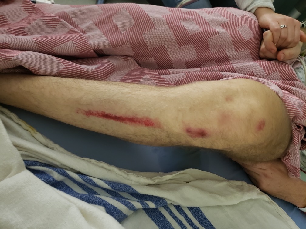 Adam Fortier, 26, an employee at the Edmonton Valley Zoo, is in the hospital after being struck by a vehicle. Dec. 11, 2019.