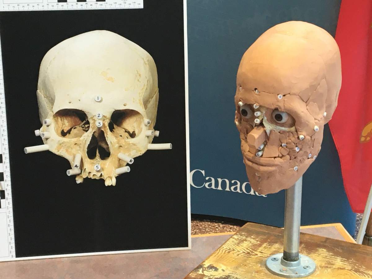 Markers that correlate to a person’s ancestry can help identify how they looked in life, based on their skulls.