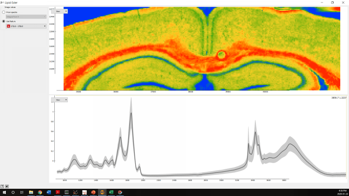 Graphic of a mouse brain with Alzheimer’s disease.
