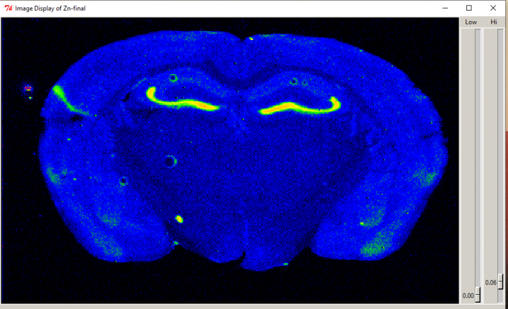 Graphic of a mouse brain affected by Alzheimer’s disease.