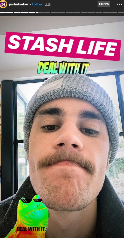 Justin Bieber/Instagram Story