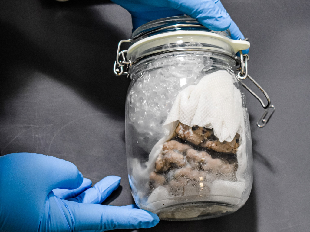 A human brain in a jar was discovered in a Canadian mail truck as it crossed the border itno Port Huron on Feb. 14.