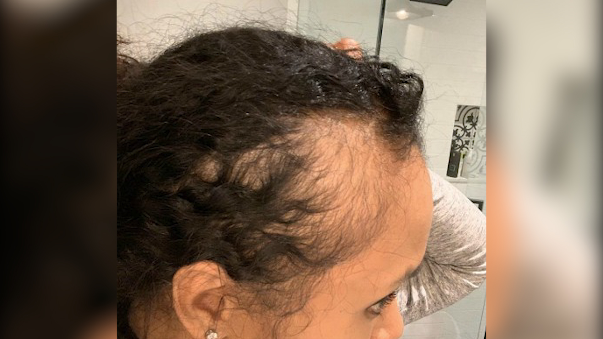 DevaCurl customers say product causes hair loss: 'It's devastating' -  National 