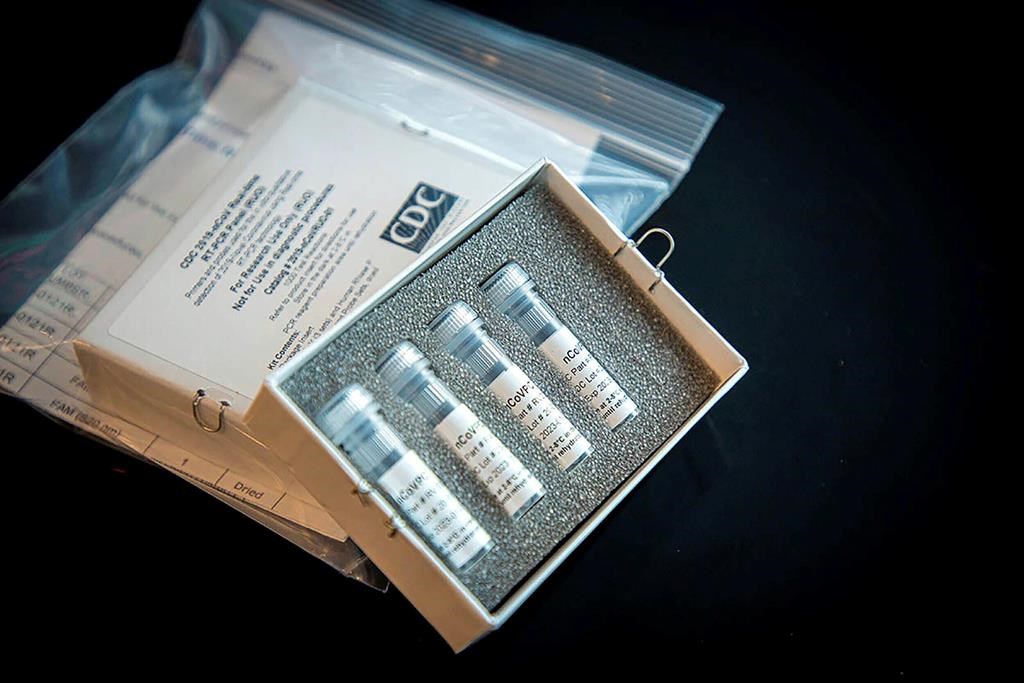 This undated photo provided by U.S. Centers for Disease Control and Prevention shows CDC’s laboratory test kit for the new coronavirus. (CDC via AP).