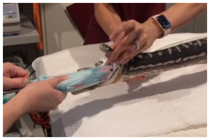 Veterinarians pull a towel out of a python at the Small Animal Specialist Hospital in Sydney, Australia, on Feb. 19, 2020.