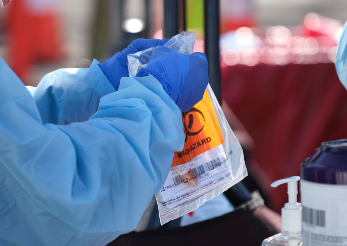A nurse seals a test kit with a specimen from a patient at a patient at a coroanvirus drive through testing location in Seattle, Washington, USA, 19 March 2020. UW Medicine is offering COVID-19 tests to patients with appointments after an initial screening.