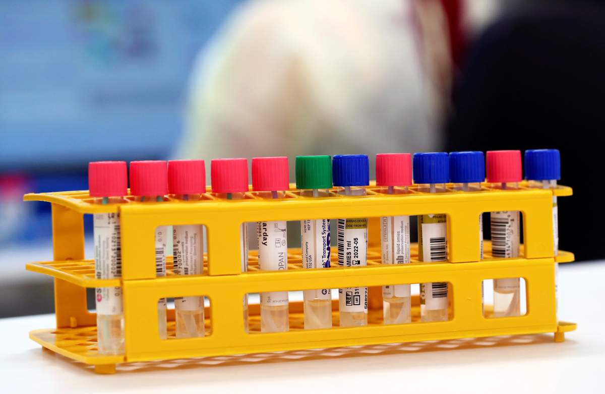 Tube tests on display at the Microbiology Laboratory of the University Hospital in Switzerland.