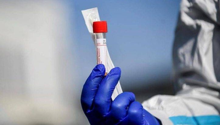 A medical personnel holds a kit for the test for Coronavirus outside one of the emergency structures that were set up to ease procedures outside the hospital of Brescia, Northern Italy, Tuesday, March 10, 2020. For most people, the new coronavirus causes only mild or moderate symptoms, such as fever and cough. For some, especially older adults and people with existing health problems, it can cause more severe illness, including pneumonia. (Claudio Furlan/LaPresse via AP).