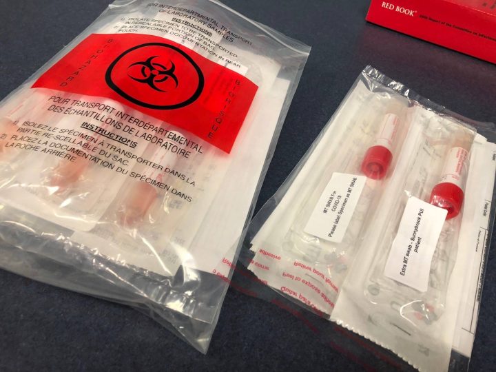 Ottawa now has a total of 385 cases of COVID-19 in the region, as of Tuesday.