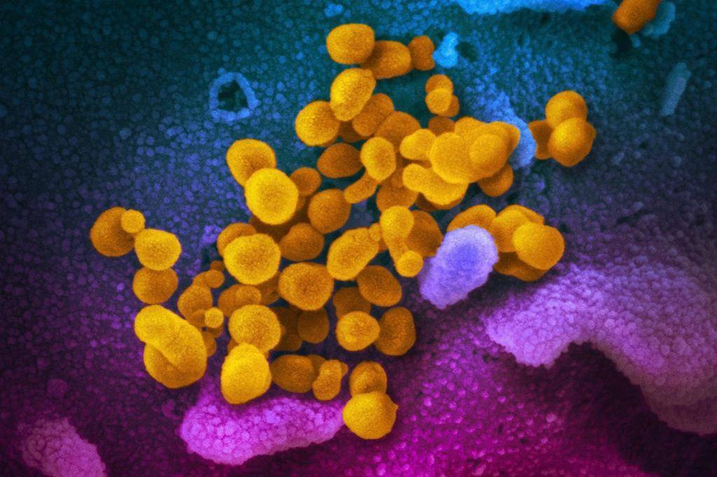 This undated electron microscope image made available by the U.S. National Institutes of Health in February 2020 shows the novel coronavirus SARS-CoV-2, yellow, emerging from the surface of cells, blue/pink, cultured in the lab. 