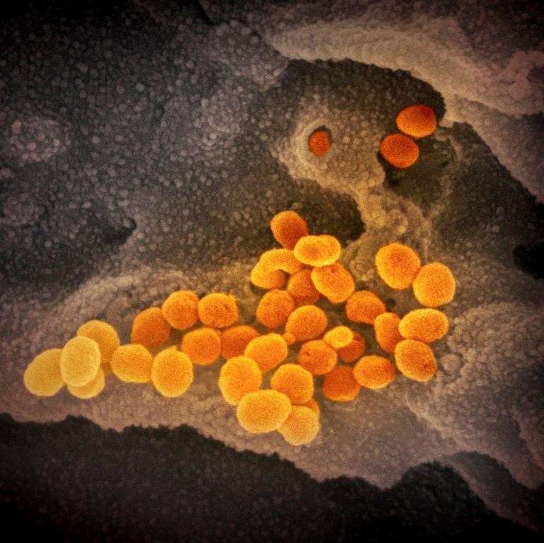 This undated electron microscope image made available by the U.S. National Institutes of Health in February 2020 shows the Novel Coronavirus SARS-CoV-2, orange, emerging from the surface of cells, gray, cultured in the lab. Also known as 2019-nCoV, the virus causes COVID-19. THE CANADIAN PRESS/AP-NIAID-RML via AP.