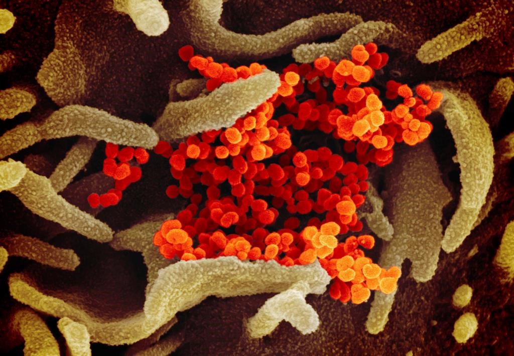 This undated electron microscope image made available by the U.S. National Institutes of Health in February 2020 shows the Novel Coronavirus SARS-CoV-2, orange, emerging from the surface of cells, green, cultured in the lab. 