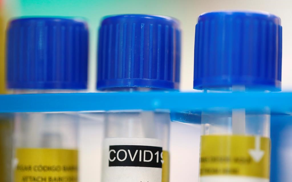 Tube tests stands in a holder as media visit the Microbiology Laboratory of the University Hospital, CHUV, during the coronavirus disease (COVID-19) outbreak in Lausanne, Switzerland, Monday, March 23, 2020.