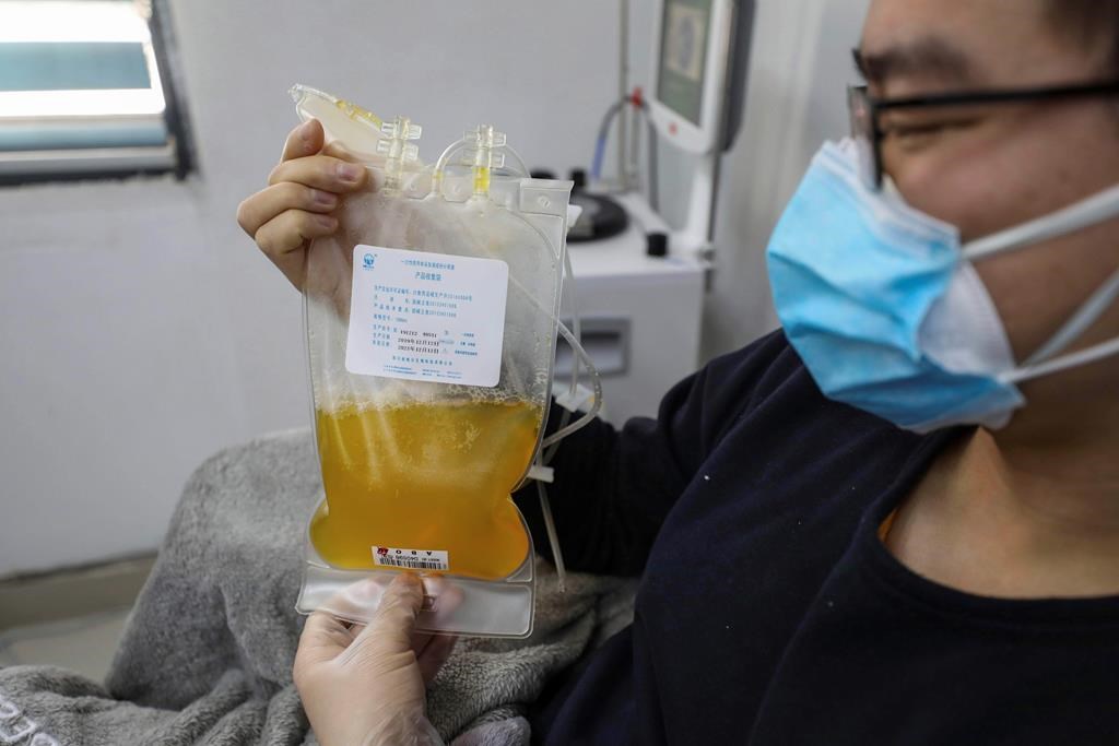 FILE - In this Feb. 18, 2020, file photo, Dr. Zhou Min, a recovered COVID-19 patient who has passed his 14-day quarantine, donates plasma in the city's blood center in Wuhan in central China's Hubei province.