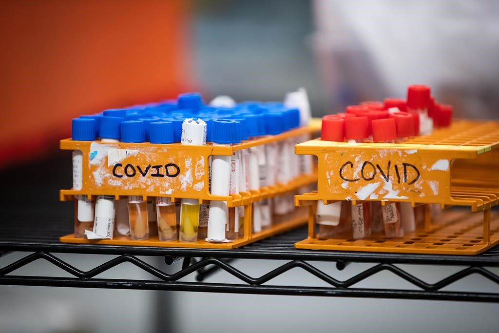 Specimens to be tested for COVID-19 are seen at LifeLabs after being logged upon receipt at the company's lab, in Surrey, B.C., on Thursday, March 26, 2020. LifeLabs is Canada's largest private provider of diagnostic testing for health care. THE CANADIAN PRESS/Darryl Dyck.