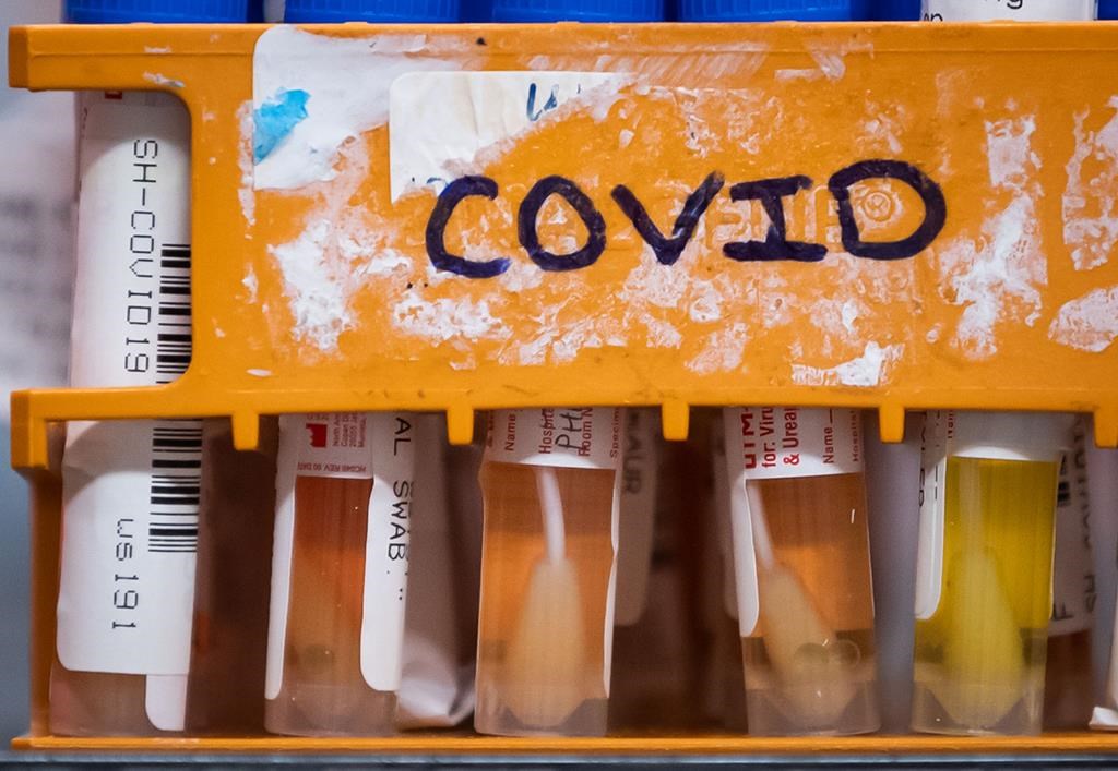 Specimens to be tested for COVID-19 are seen at LifeLabs after being logged upon receipt at the company's lab.