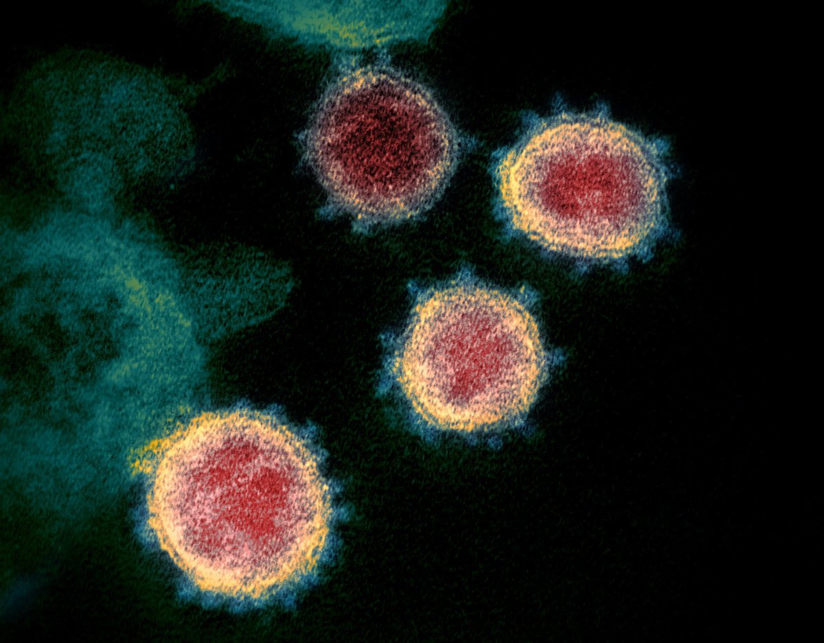 A transmission electron microscope image shows the COVID-19 virus isolated from a patient.
