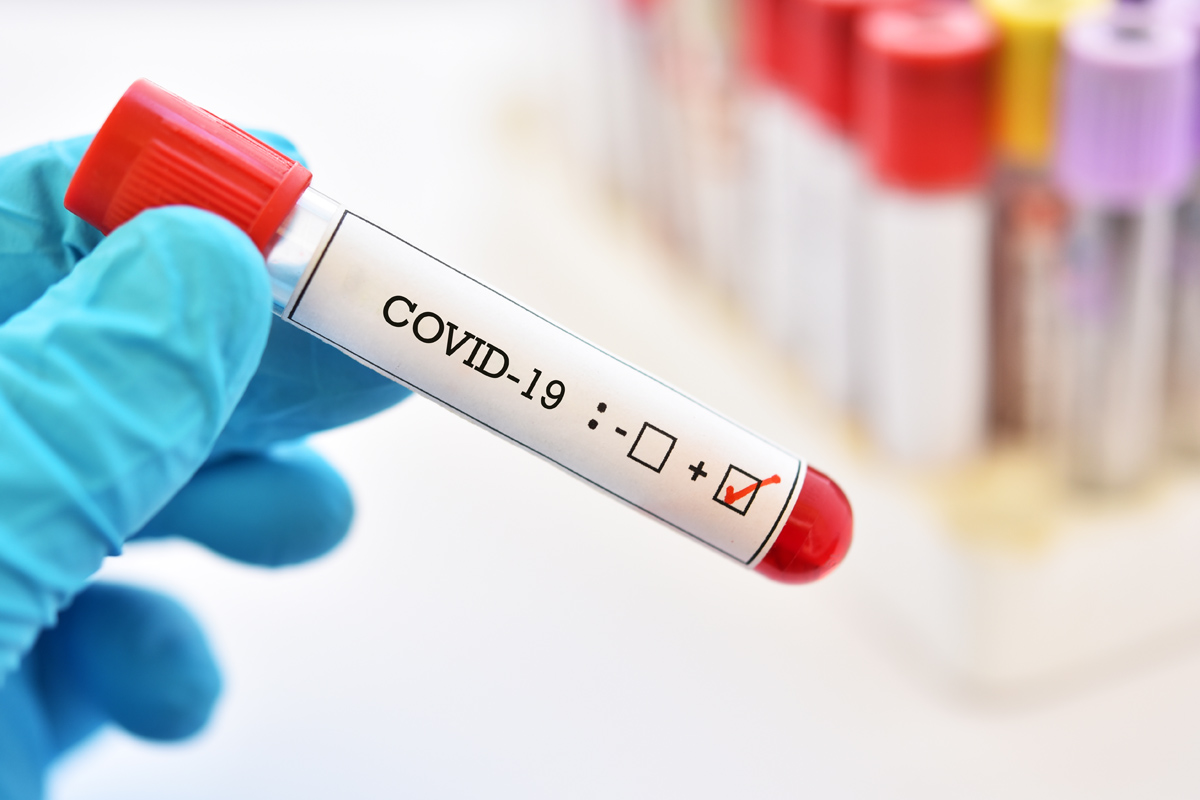 Blood sample tube positive with COVID-19 or novel coronavirus 2019 found in Wuhan, China.