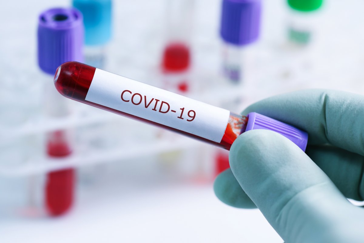 65 confirmed cases of COVID-19 have been reported by the Haliburton, Kawartha, Pine Ridge District Health Unit.