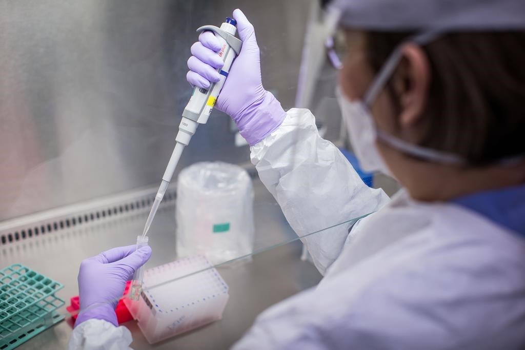 Katie Kempton, a laboratory technologist at LifeLabs, demonstrates one of the steps taken when a specimen is tested for COVID-19 at the company's lab, in Surrey, B.C., on March 26, 2020. A former deputy medical health officer in Saskatchewan believes the province should adopt a more active testing strategy for COVID-19 as it prepares lift restrictions on public interaction. E CANADIAN PRESS/Darryl Dyck.