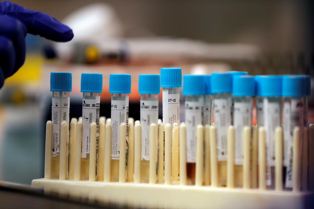 Vials with samples taken for the new coronavirus are counted before they are prepared for RNA testing at the molecular pathology lab at Tulane University School of Medicine in New Orleans, Thursday, April 2, 2020.