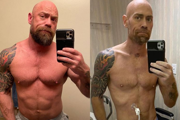 Mike Schultz, 43, is shown before (left) and after his COVID-19 diagnosis.