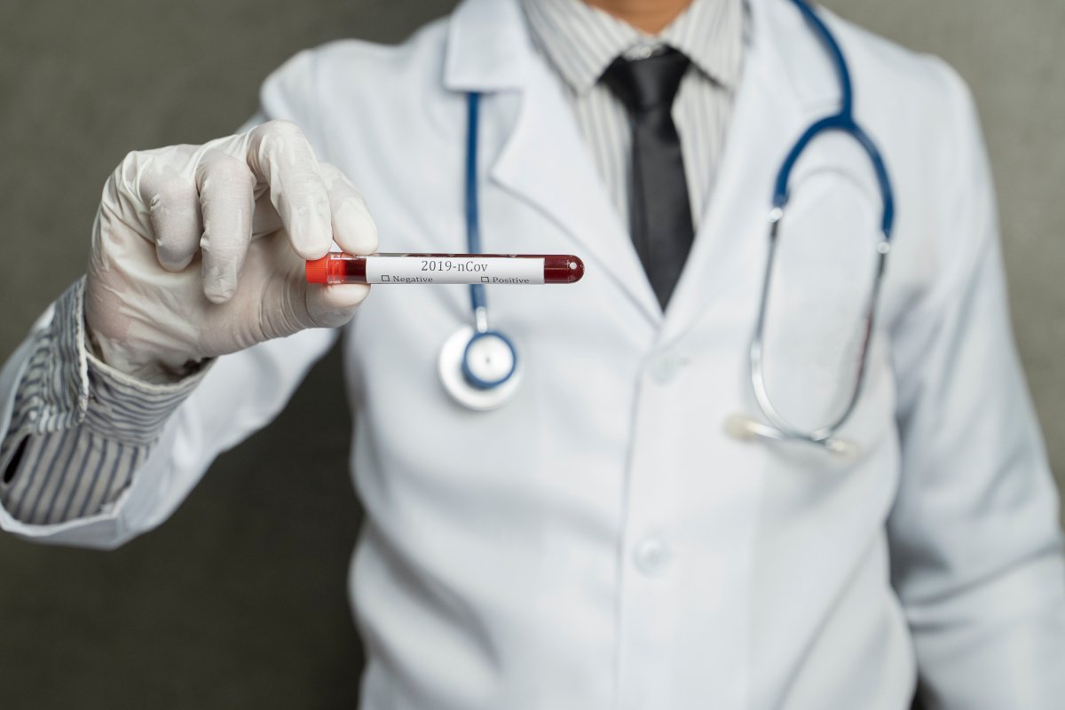The Haliburton, Kawartha, Pine Ridge District Health Unit reports 170 coronavirus cases in its jurisdiction on Monday.