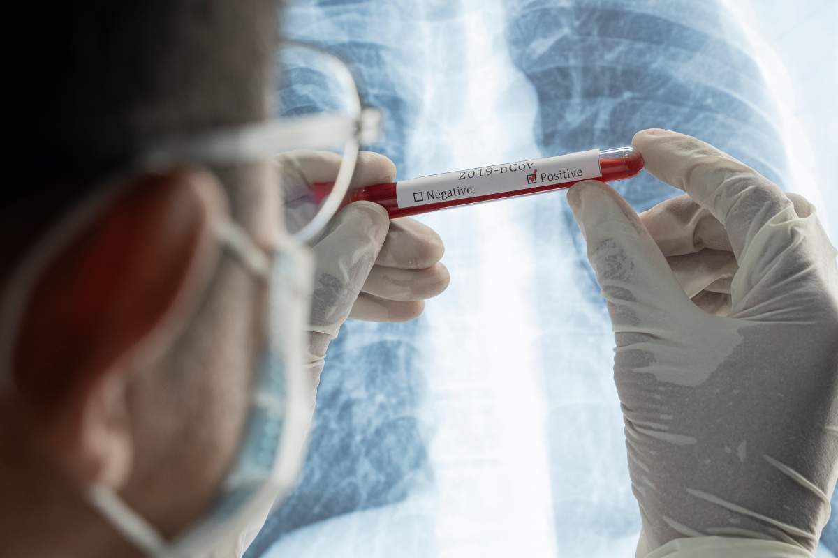 The Haliburton, Kawartha, Pine Ridge District Health Unit reports 170 confirmed cases of coronavirus in its jurisdiction on Tuesday.