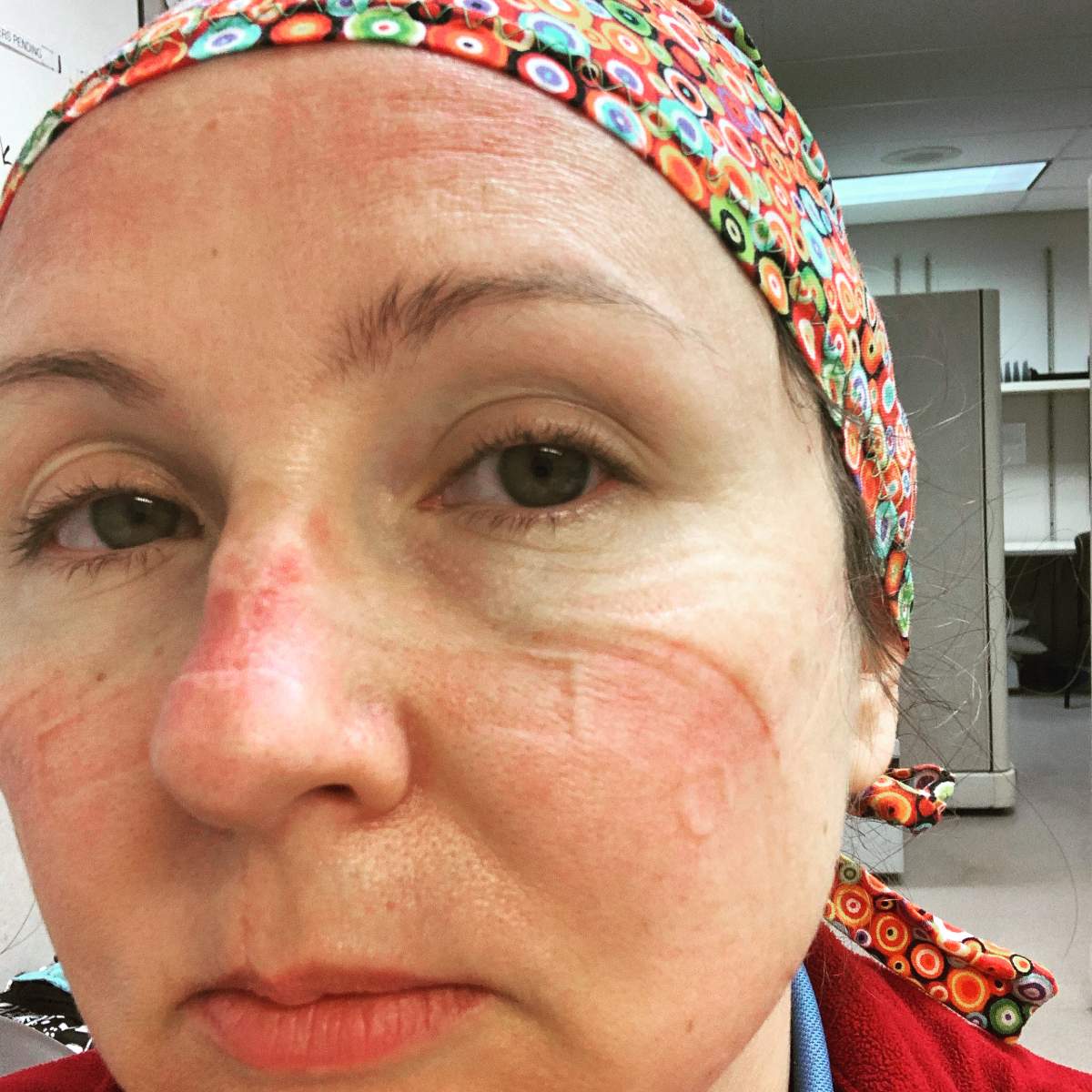 Amy Taylor after working a 12-hour shift with a face mask on.