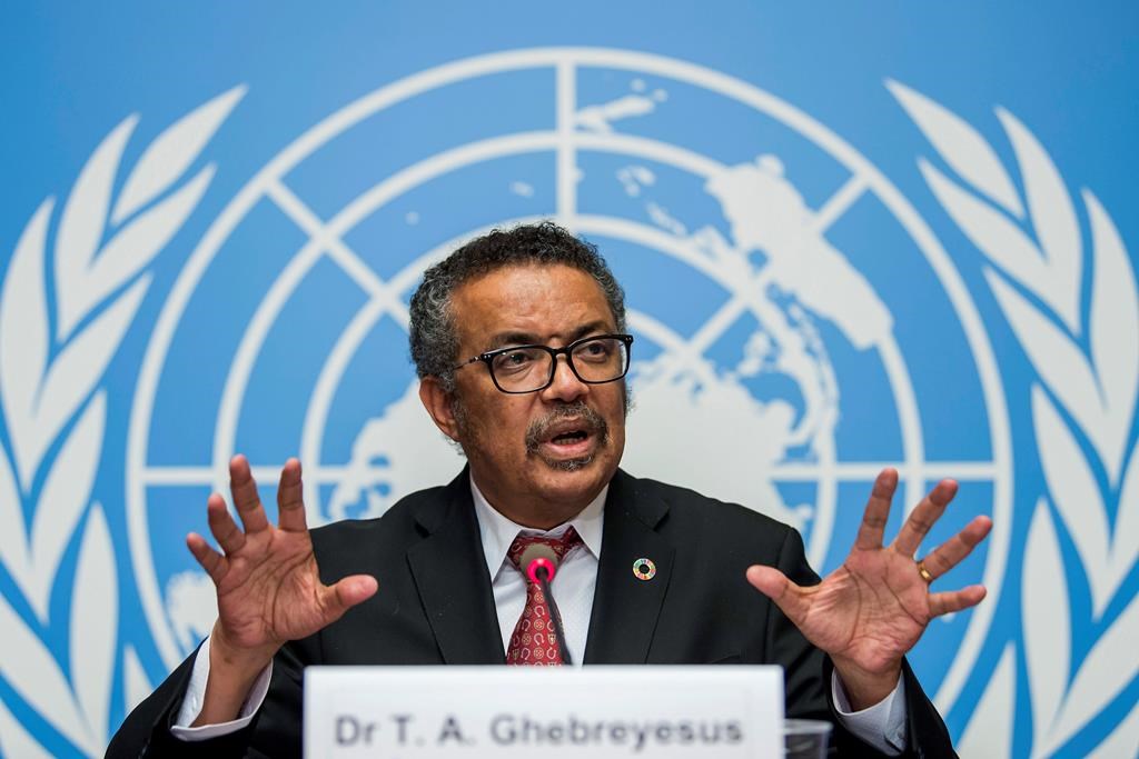 FILE-Int this Feb. 7, 2018 file photo Tedros Adhanom Ghebreyesus, director general of the World Health Organization (WHO), answers questions of the journalists about his first seven months in office and outlines the organization's priorities for the next five years, at the European headquarters of the United Nations in Geneva, Switzerland. The World Health Organization‚Äôs director-general has faced many challenges during the coronavirus pandemic: racial slurs, death threats, social media caricatures ‚Äî he was once depicted as a ventriloquist‚Äôs dummy in the hands of Chinese President Xi Jinping ‚Äî and U.S. funding cuts. (Martial Trezzini/Keystone via AP).