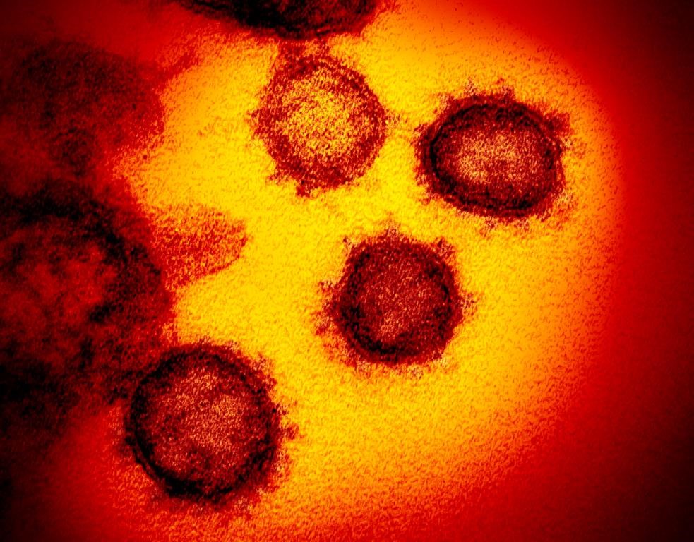 FILE - This undated electron microscope image made available by the U.S. National Institutes of Health in February 2020 shows the Novel Coronavirus SARS-CoV-2, the virus causes COVID-19.
