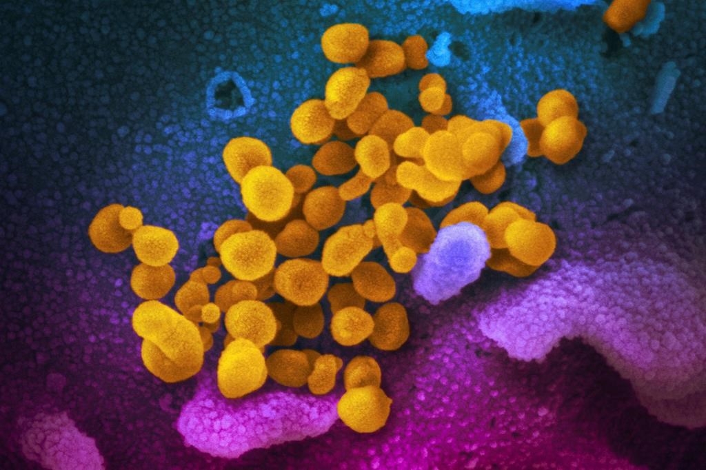 FILE - This undated electron microscope image made available by the U.S. National Institutes of Health in February 2020 shows the Novel Coronavirus SARS-CoV-2, yellow, emerging from the surface of cells, blue/pink, cultured in the lab. The sample was isolated from a patient in the U.S. THE CANADIAN RESS/NIAID-RML via AP, File.