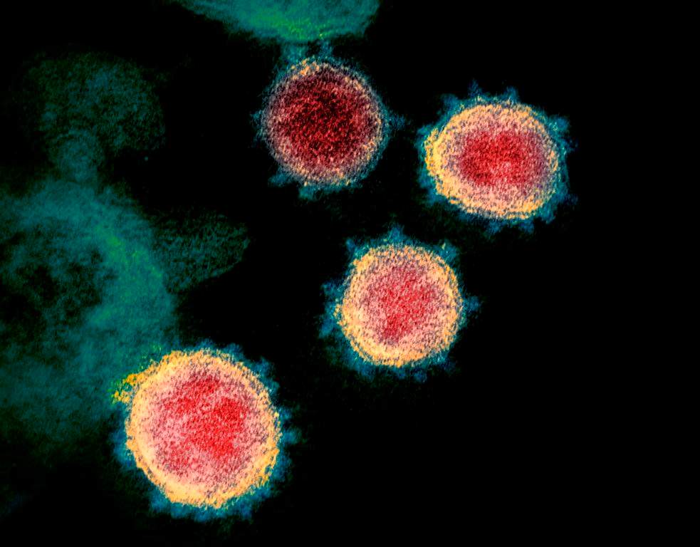 ollowing Disease Control Regulations, anyone who rode on the Birmingham's shuttle should self-monitor for COVID-19 symptoms until Aug. 20. .