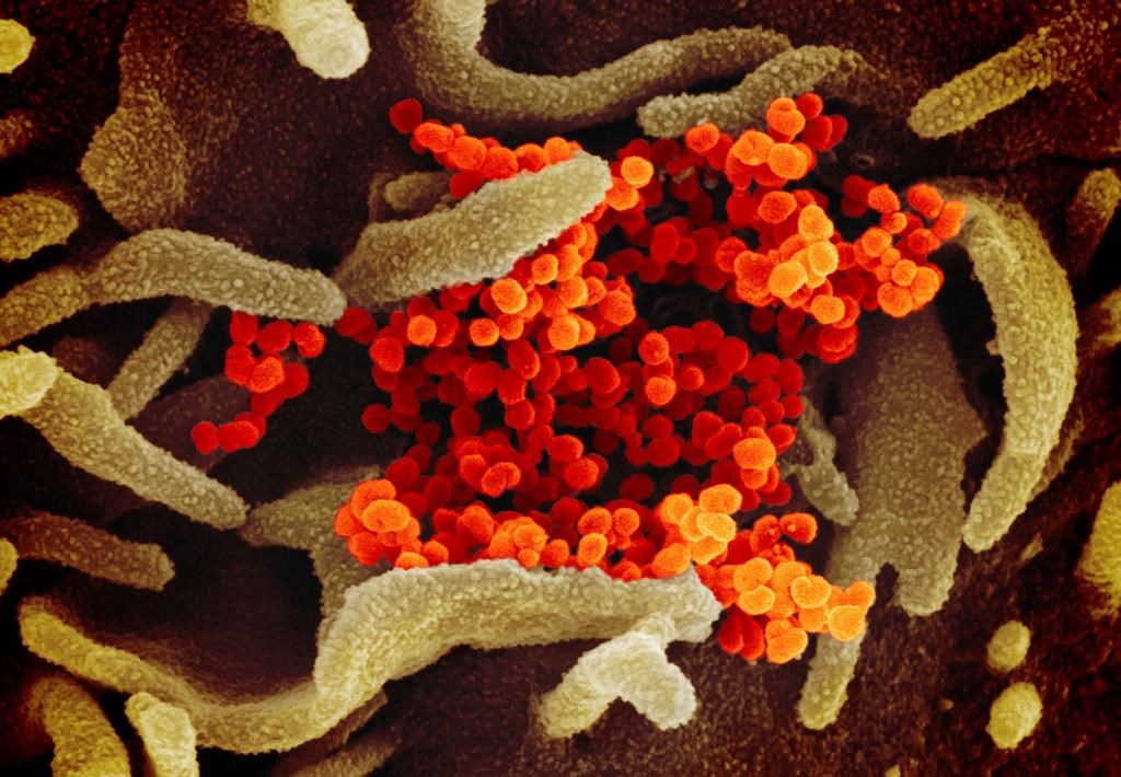 This undated electron microscope image made available by the U.S. National Institutes of Health in February 2020 shows the Novel Coronavirus SARS-CoV-2, orange, emerging from the surface of cells, green, cultured in the lab.