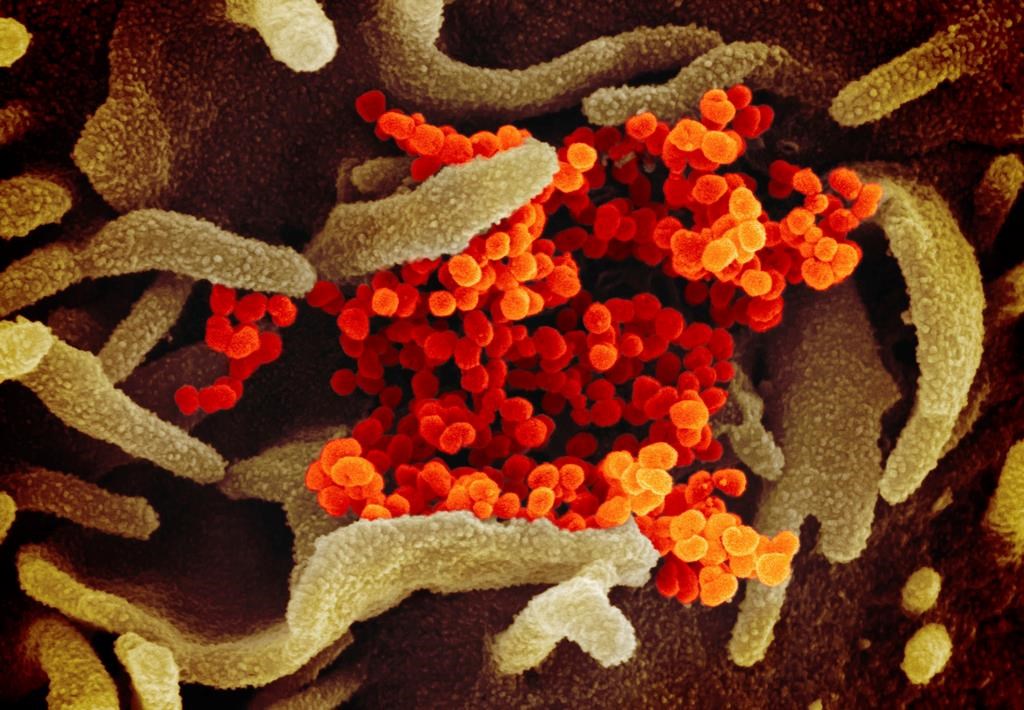 This undated electron microscope image made available by the U.S. National Institutes of Health in February 2020 shows the Novel Coronavirus SARS-CoV-2, orange, emerging from the surface of cells, green, cultured in the lab. Also known as 2019-nCoV, the virus causes COVID-19. The sample was isolated from a patient in the U.S. THE CANADIAN PRESS/AP-NIAID-RML via AP.