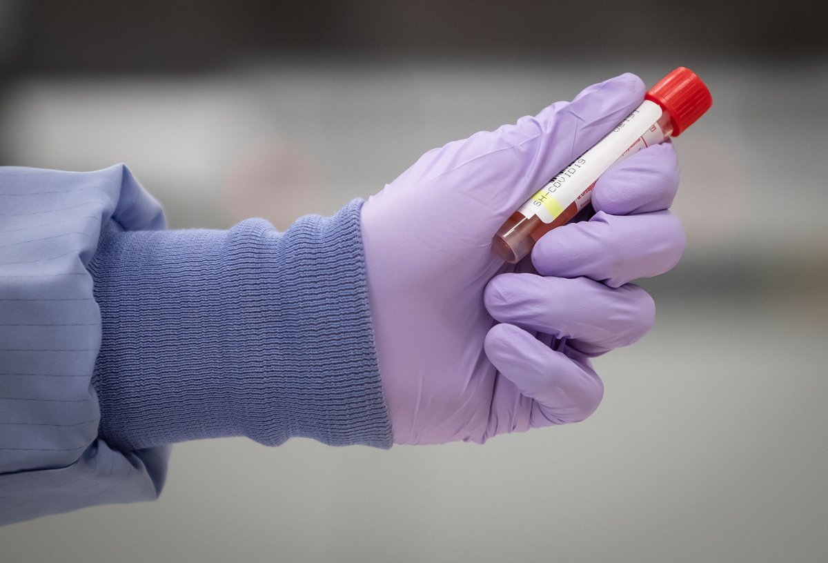 A laboratory technical assistant at LifeLabs, handles a specimen to be tested for COVID-19 after scanning its barcode upon receipt at the company's lab, in Surrey, B.C., on Thursday, March 26, 2020. 