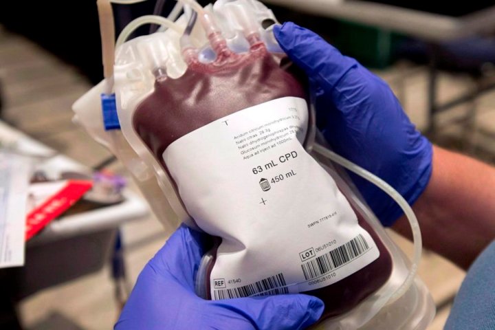 Conservative MP pushes health minister to end limits on blood donations from gay men