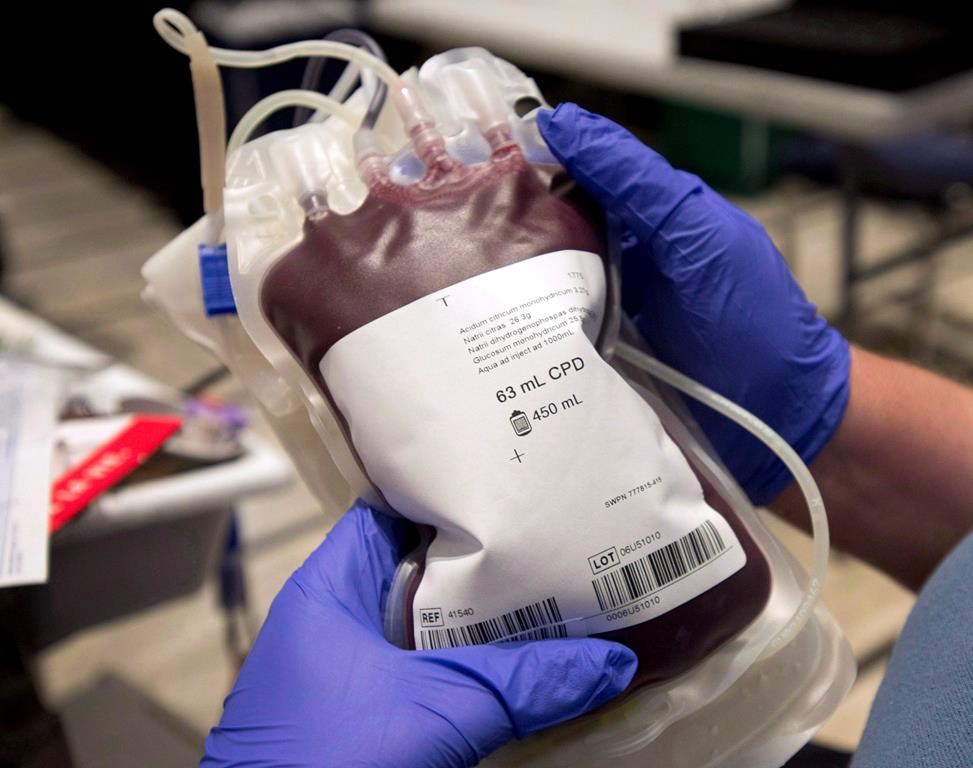 A bag of blood is shown at a clinic in Montreal, Thursday, November 29, 2012. THE CANADIAN PRESS/Ryan Remiorz.