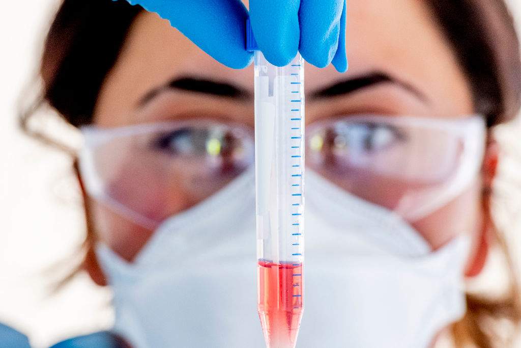 A health worker holding a test tube with samples from a suspected COVID-19 patient is seen in this file image. 