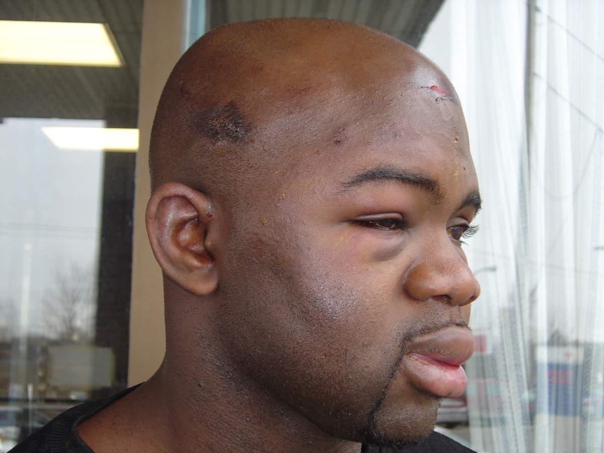 After George Floyd death, former CFL player relives nightmare with police: ‘I am him’ - image