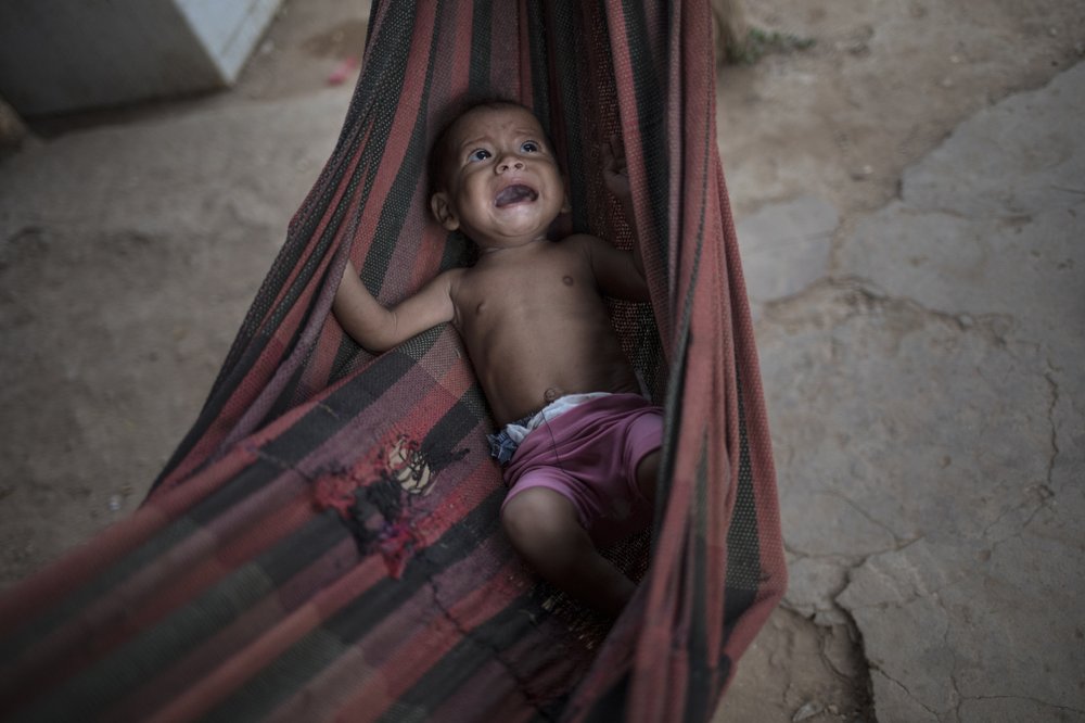 FILE – In this Nov. 25, 2019 file photo, Osmery Vargas, who is malnourished, cries in a hammock as she and her 7-year-old sister Yasmery Vargas wait for their mother to return from begging in the street for money and food in Maracaibo, Venezuela. Even before the coronavirus pandemic in 2020, inflation had rendered many salaries nearly worthless and forced millions to flee abroad.