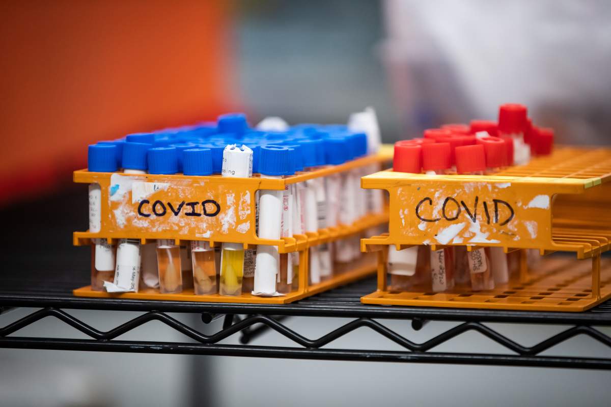 Specimens to be tested for COVID-19 are seen at LifeLabs after being logged upon receipt at the company's lab, in Surrey, B.C., on Thursday, March 26, 2020. 