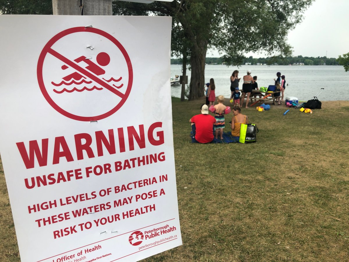 Jones Beach in Bridgenorth on Tuesday afternoon. Peterborough Public Health has listed the beach and Lakefield Park beach both unsafe for swimming.