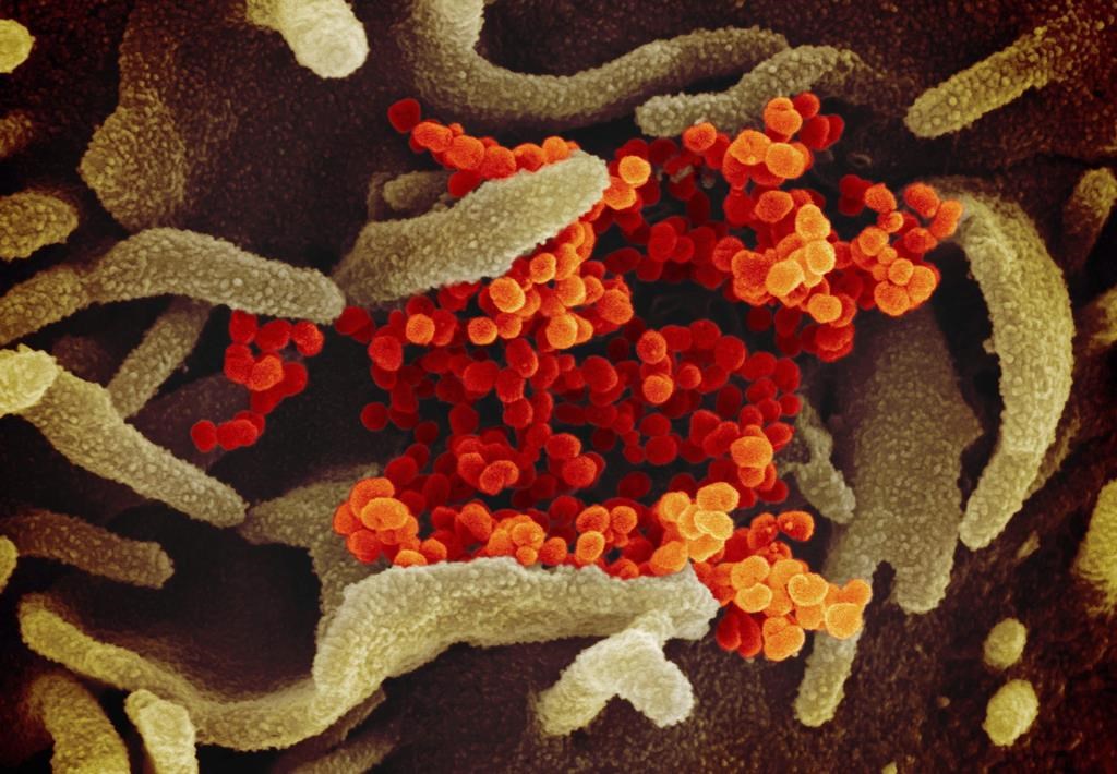 An electron microscope image of the novel coronavirus SARS-CoV-2 (seen here in orange) emerging from the surface of cells (seen in green).