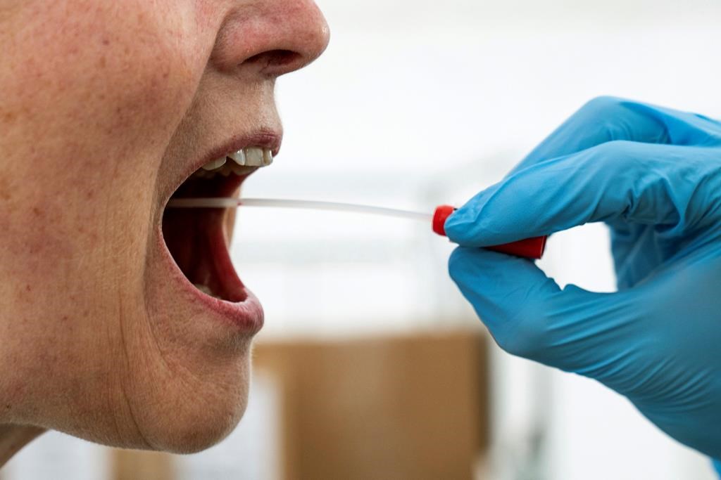 A medical worker performs a mouth swab on a patient to test for Covid-19 coronavirus, in tent extension of the Rigshospitalet Hospital, in Copenhagen, Denmark, Thursday, April 2, 2020.