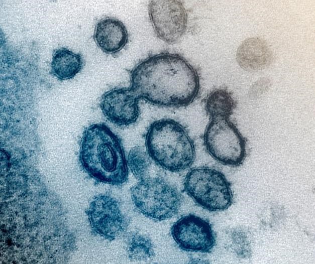 This undated electron microscope image made available by the U.S. National Institutes of Health in February 2020 shows the Novel Coronavirus SARS-CoV-2. Also known as 2019-nCoV, the virus causes COVID-19. The sample was isolated from a patient in the U.S. Dozens of research groups around the world are racing to create a vaccine as COVID-19 cases continue to grow. THE CANADIAN PRESS/AP-NIAID-RML via AP.