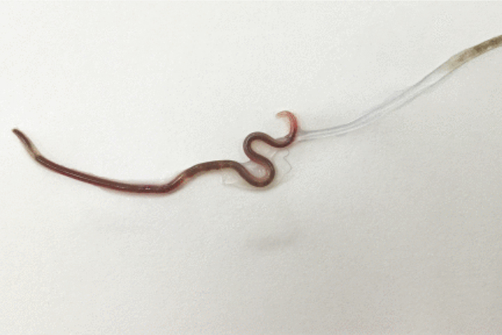A molting nematode roundworm is shown in this handout photo.