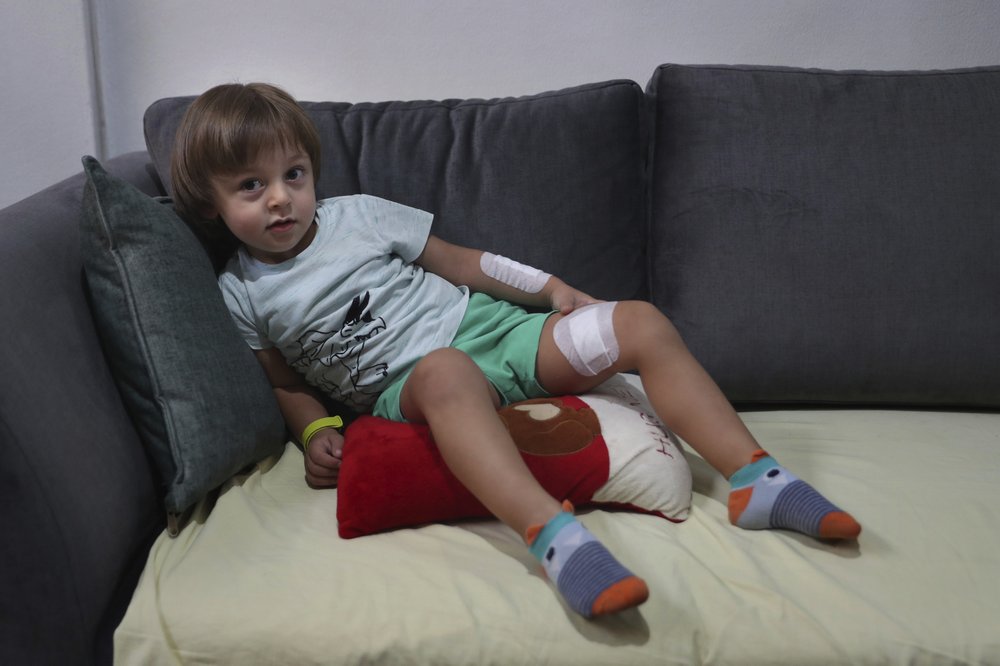 Three-year-old Abed Itani lies on a sofa at his family house in Beirut, Lebanon, Tuesday, Aug. 11, 2020. Abed was playing with his Lego blocks when the huge blast ripped through Beirut, shattering the nearby glass doors.