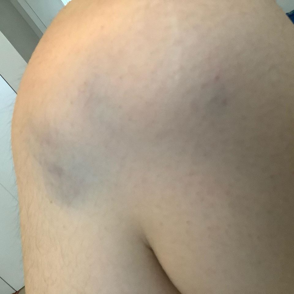 UBC student says no one intervened as she was attacked, robbed on Vancouver bus - image